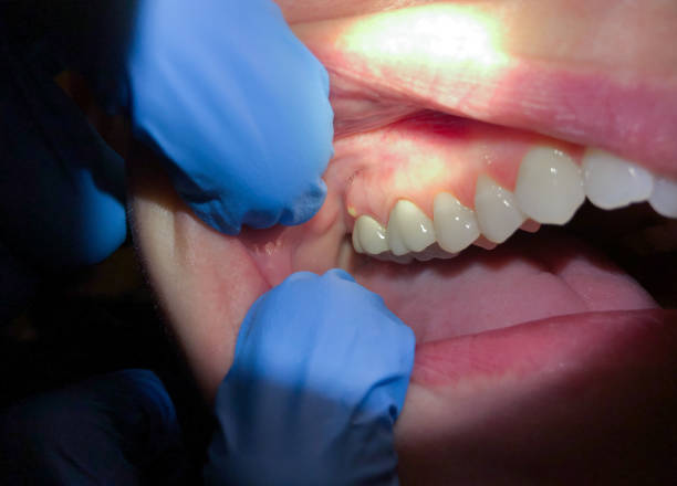 Best Emergency Orthodontic Services in Tashua, CT