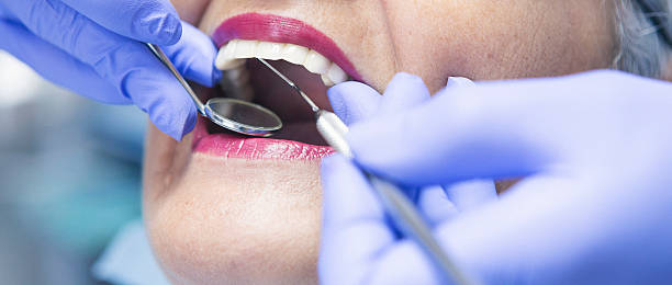 Best Emergency Treatment for Dental Infections or Abscesses in Tashua, CT